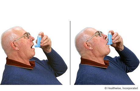 A man holding the inhaler in two positions